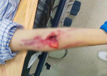 影音/少年騎車自摔脾臟碎裂 彰基整合創傷團隊成功搶救