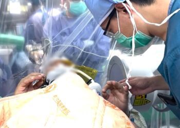 用DBS手術改善帕金森氏症 彰基清醒手術助攻 術後病患顫抖與僵硬症狀顯著改善