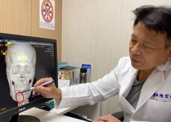 兩歲孩往媽媽鼻子一撞鼻骨竟斷了 醫師呼籲:顏面受傷把握黃金治療期